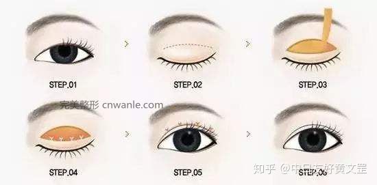 零成本实现双眼皮梦想，家庭实用小窍门与安全指导全解析