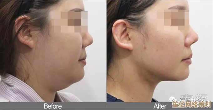 双下巴消除指南:自然方法打造清晰面部轮廓 双下巴消除指南:自然方法打造清晰面部轮廓