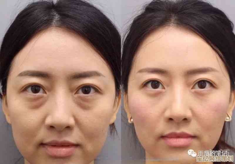 专业去眼袋方法全解析，助你摆脱疲惫双眼重拾自信
